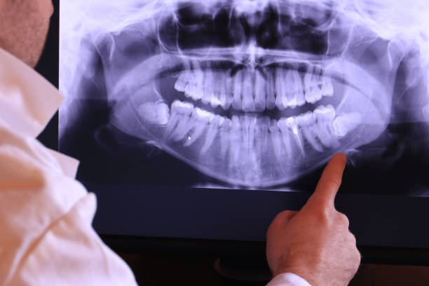 Best Emergency Dental Care for Abscessed Tooth in Salem, AR